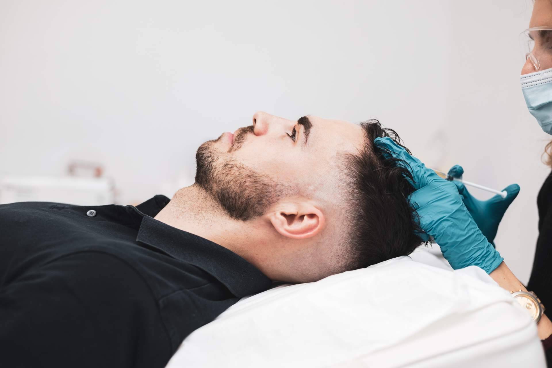 Recuperar el cabello sin pasar por quirófano; la alternativa al trasplante capilar que gana interés
